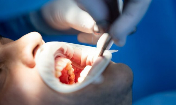 Periodontoloji - Diş Eti Hastalıkları
